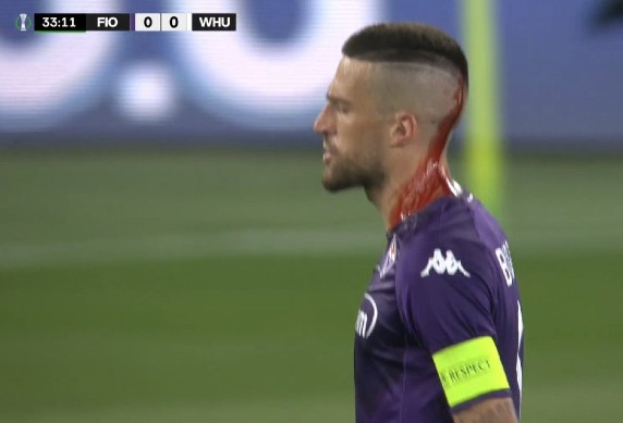 Fiorentina Player Injured Conference League Final 2023